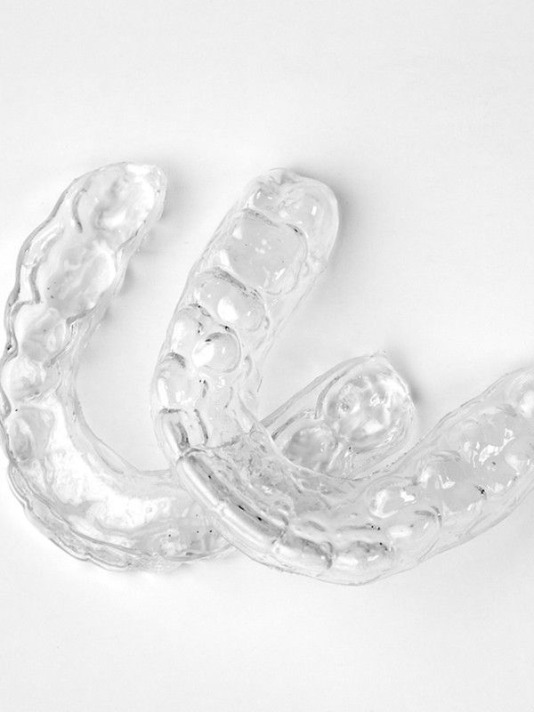 What You Need To Know About Invisalign
