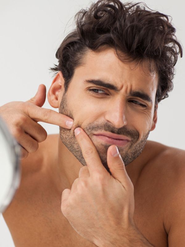 SLMan Clinic: How To Tackle Adult Acne