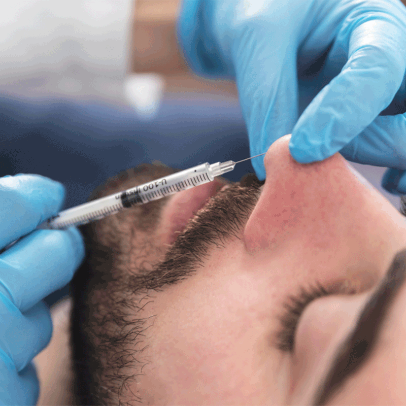 All About Liquid Nose Jobs