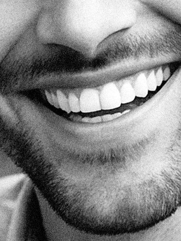 Everything To Know About Teeth Whitening Today