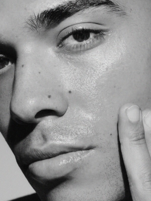 Everything To Know About ‘Bro-tox’